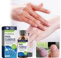 Tratament pentru onicoliza unghiilor GlamStoreBeauty 